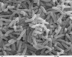Vibrio cholerae: Scanning electron microscope (SEM)